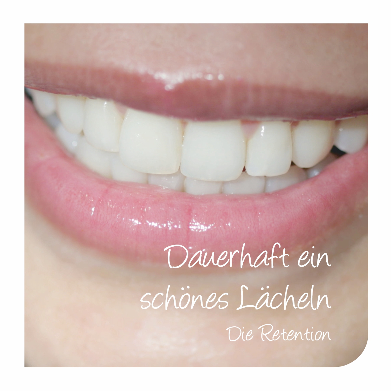 04 Retention-Titel