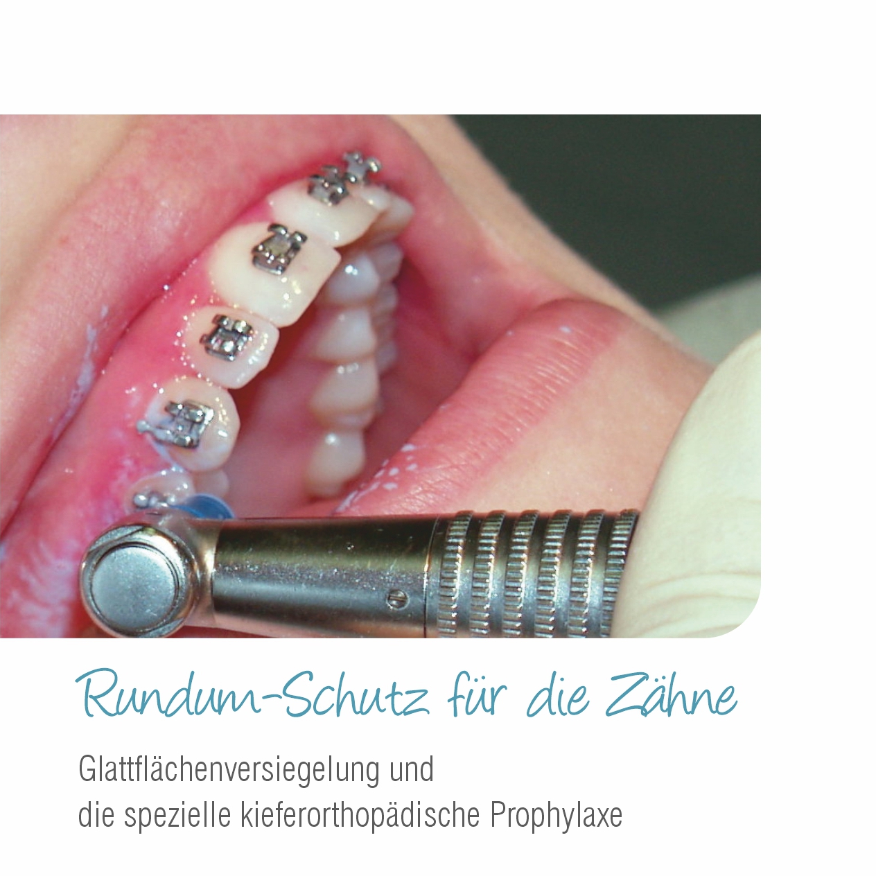 11 Rundum-Schutz für die Zähne